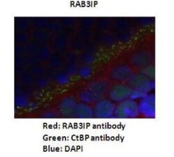 RAB3IP Antibody, Novus Biologicals 100&mu;L; Unlabeled:Antibodies, Polyclonal